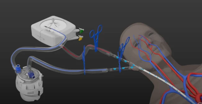 Quantum Flexible Solutions for all of your Cardiopulmonary Bypass Procedures