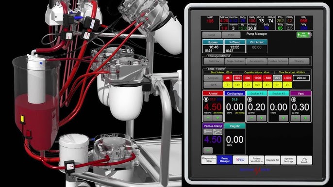 ECMO Flexible ECLS Solutions for the I.C.U. and Patient Transport